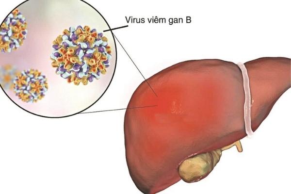 Phòng viêm gan B cho trẻ bằng cách tiêm vắc xin Hexaxim