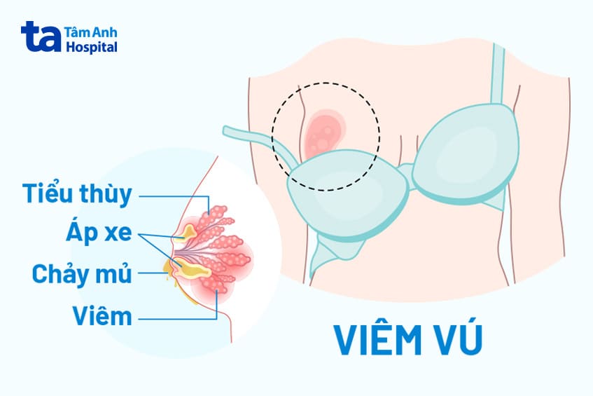 điều trị đầu ti bị khô