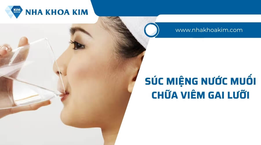 Cách điều trị bệnh viêm gai lưỡi