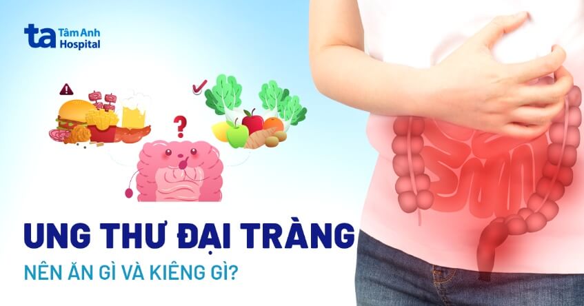 ung thư đại tràng nên ăn gì kiêng gì