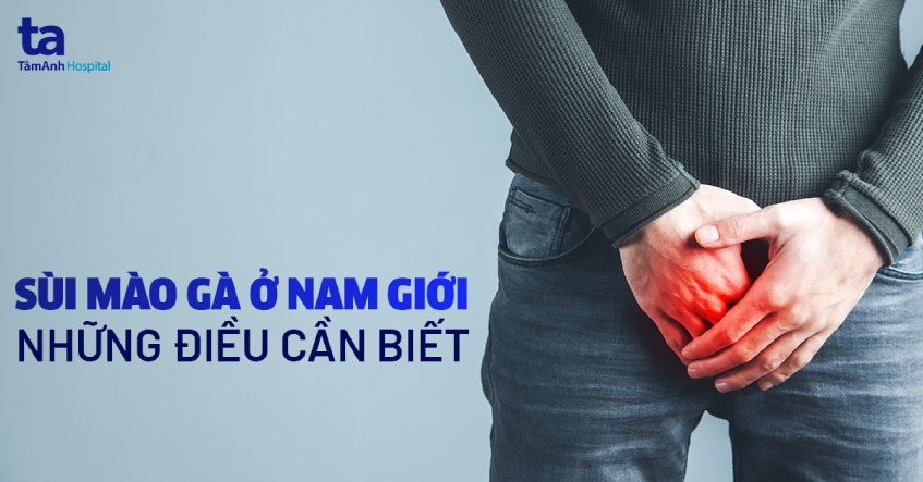 sùi mào gà ở nam giới