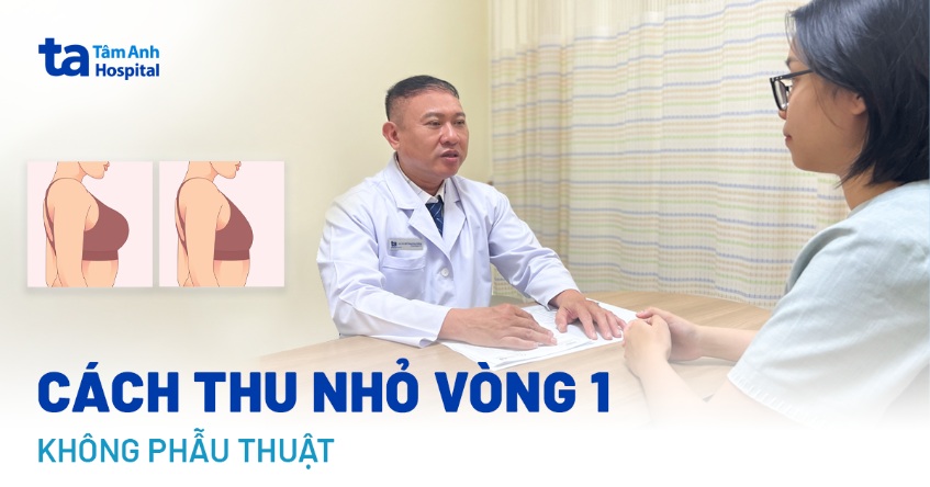 thu nhỏ vòng 1 không phẫu thuật