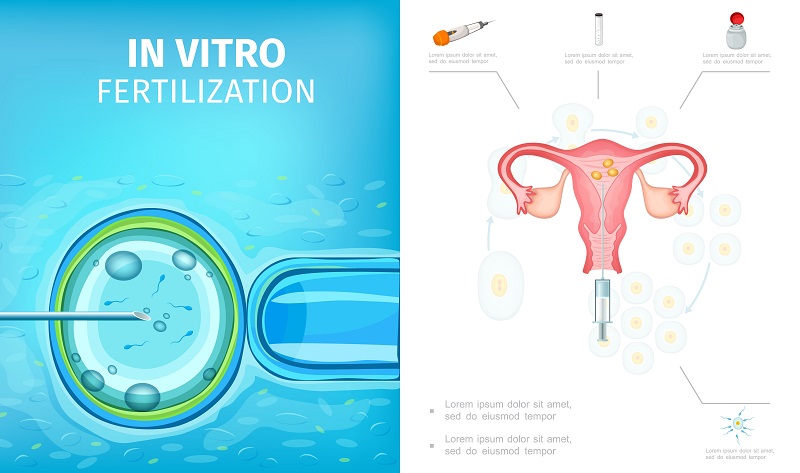 Thụ tinh trong ống nghiệm IVF là phương pháp tỷ lệ thành công cao.