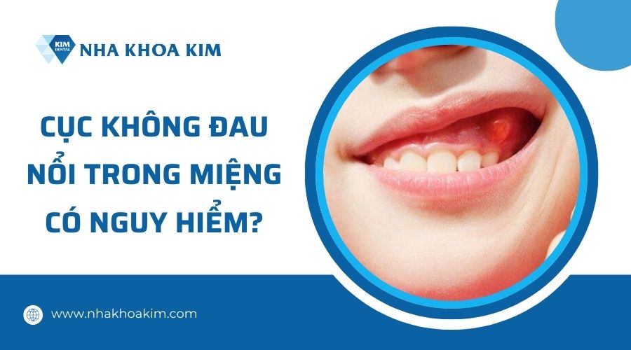 Miệng nổi cục không đau có nguy hiểm không?