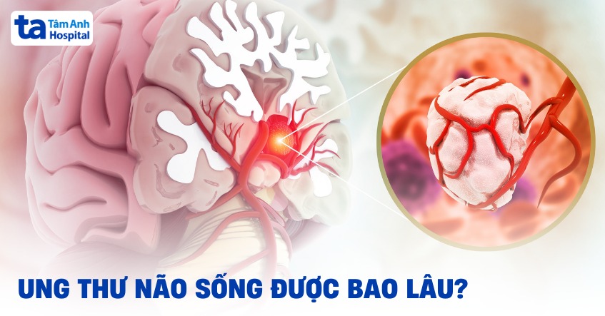 ung thư não sống được bao lâu