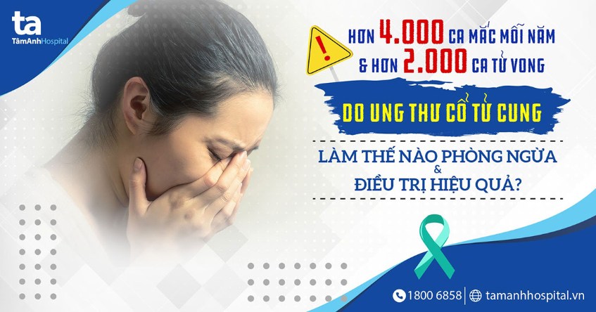 ung thư cổ tử cung