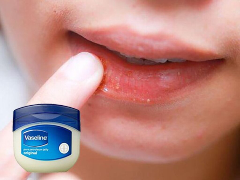 vaseline-duong-moi-la-gi-vaseline-duong-moi-loai-nao-tot-nhat 2