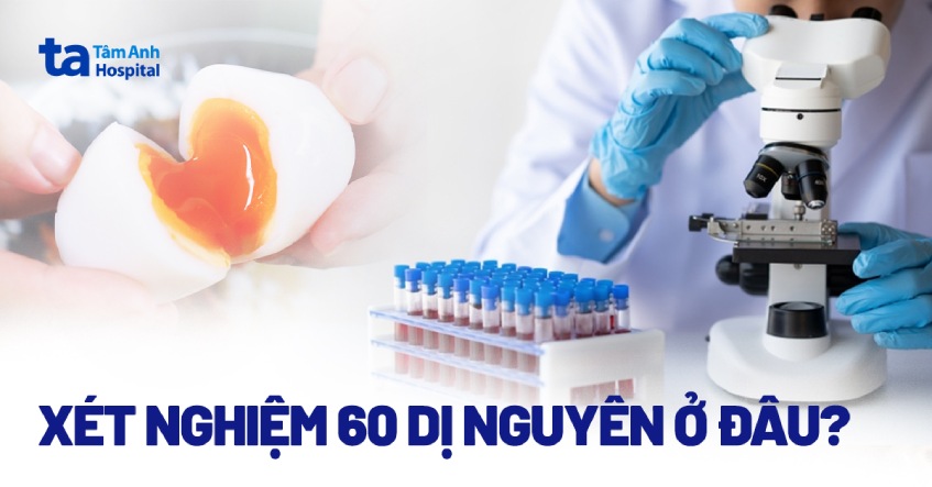 xét nghiệm 60 dị nguyên giá bao nhiêu tiền