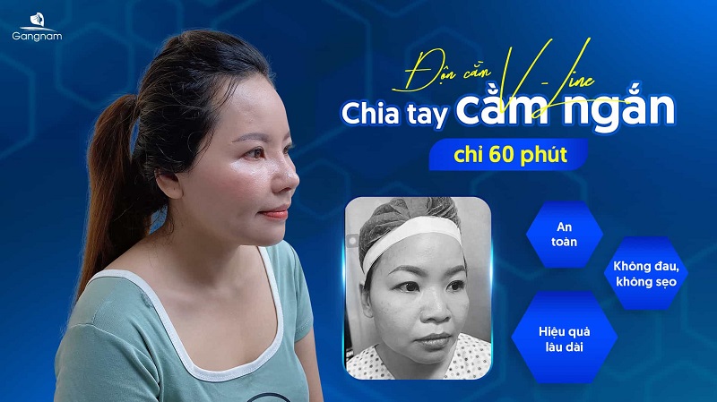 Cằm ngắn là gì?