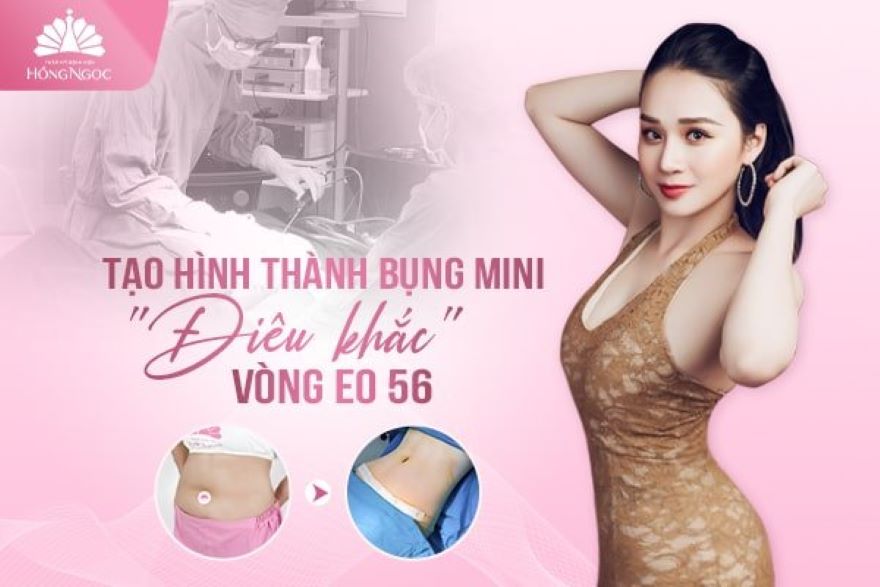 tạo hình thành bụng mini