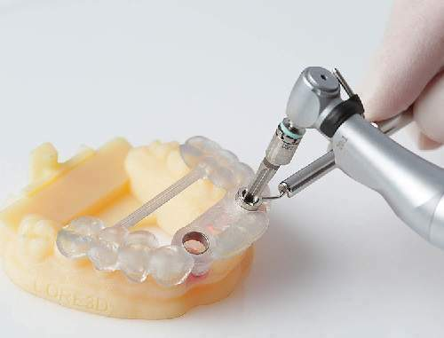 Máng hướng dẫn phẫu thuật cấy Implant