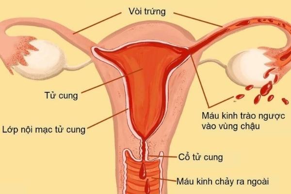 Nội mạc tử cung là lớp bao phủ toàn bộ bề mặt phía trong tử cung