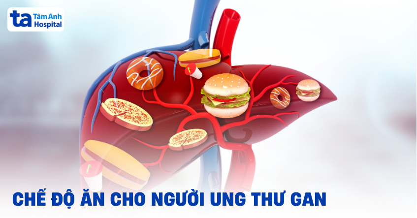 chế độ ăn cho người ung thư gan